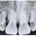 وحدة الأسنان X-RAY